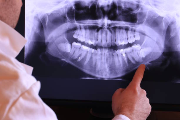 Best Broken Tooth Emergency  in Man, IL