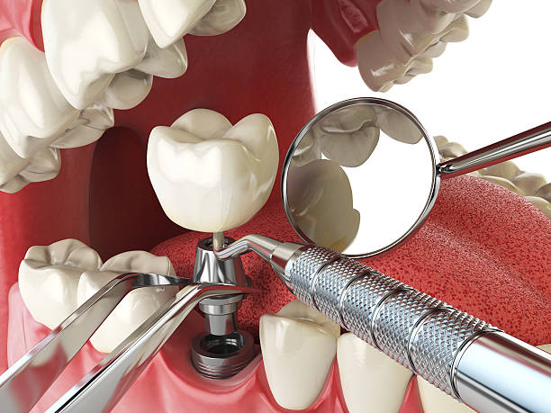 Best Cracked Tooth Emergency Dentist  in Man, IL